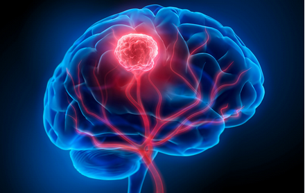 Brain Cancer Drug