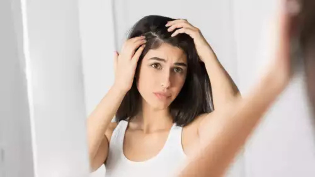 খুশকি