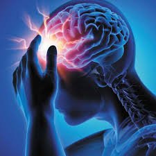 Brain aneurysms are silent killers